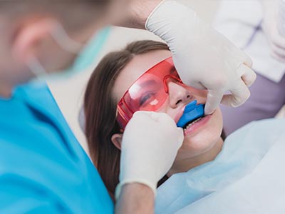 Fluoride Treatment