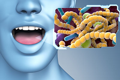 The image features a 3D rendering of a person with a large amount of yellow and green bacteria or microorganisms on their face, mouth open as if speaking or singing, with a graphic overlay showing a close-up view of these bacteria.