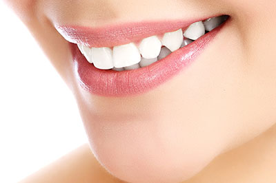 The image shows a close-up of a person s smiling face with visible teeth, set against a neutral background.