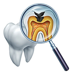 The image shows a magnified view of a tooth with an X-ray scan overlaying it, revealing internal dental structures including the pulp chamber, root canals, and nerve endings.