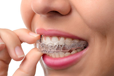 The image shows a person with a smile, wearing braces, holding their teeth apart with their fingers, and looking directly at the camera.