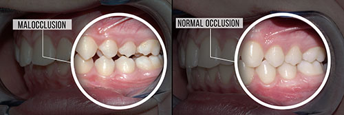 The image shows a sequence of three photos with annotations highlighting a process of tooth restoration, featuring a mouth with missing teeth before treatment, during the procedure, and after completion.