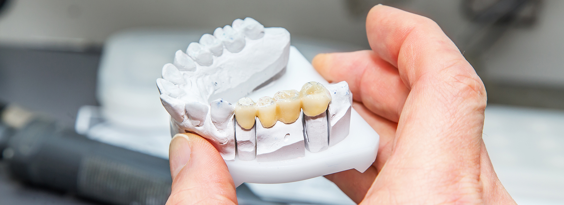 A person s hand holding a set of dentures with teeth missing over a blurred background.