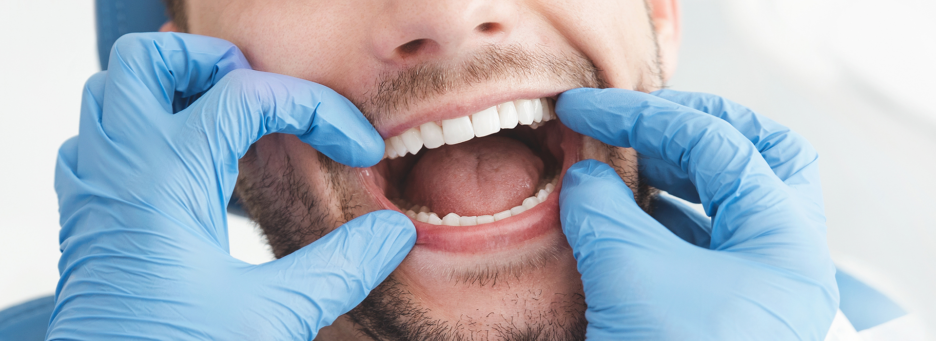 A man wearing blue medical gloves holds his mouth open, displaying a wide smile with teeth, while another person s hand covers his mouth, possibly indicating a dental procedure or consultation.