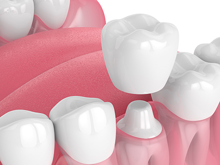 The image features a vibrant display of artificial teeth on a pink background, arranged neatly in rows, showcasing their design and color variations.